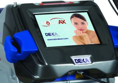 DEKA 5